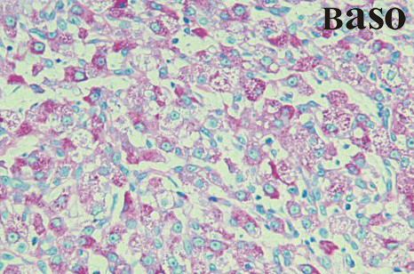 PAS Hepatin Stain