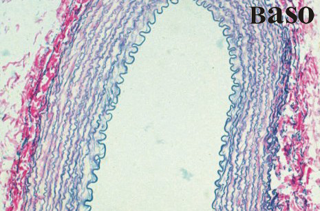 Elastic Fiber EVG Stain